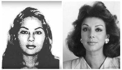 J&B's Before and after 39 Shoulders up to and face lift treatments